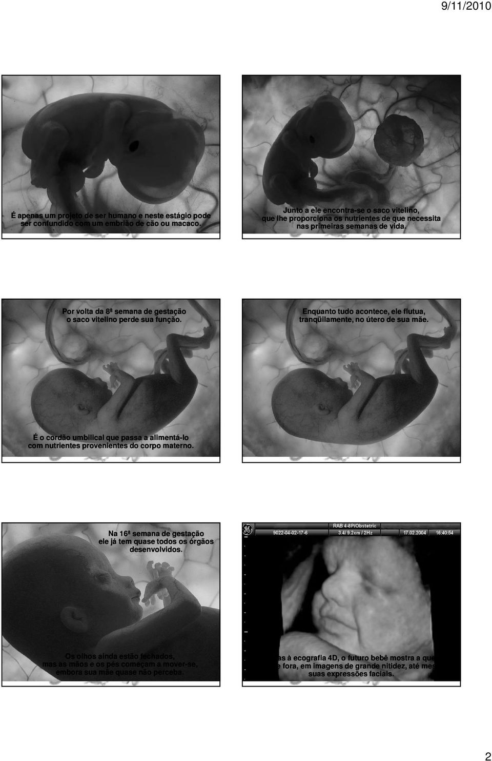 Enquanto tudo acontece, ele flutua, tranqüilamente, no útero de sua mãe. É o cordão umbilical que passa a alimentá-lo lo com nutrientes provenientes do corpo materno.