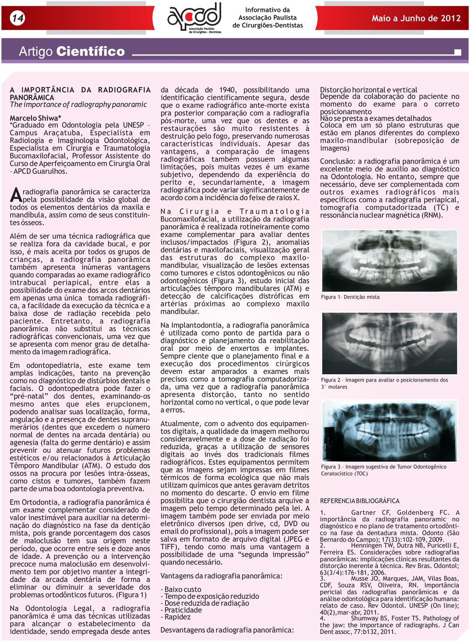 radiografia panorâmica se caracteriza Apela possibilidade da visão global de todos os elementos dentários da maxila e mandíbula, assim como de seus constituintes ósseos.