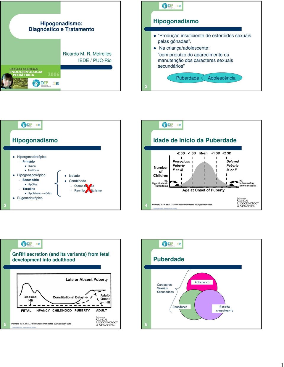 Testículo Hipogonadotrópico Secundário Hipófise Terciário Hipotálamo córtex Eugonadotrópico Isolado Combinado X Outras trofinas Pan-hipopituitarismo 4 Palmert, M. R. et al.