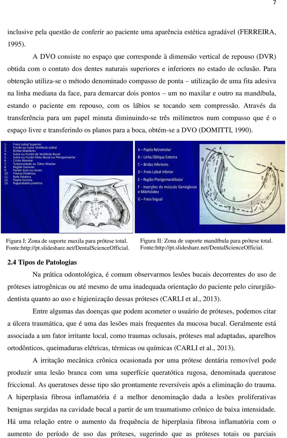 Para obtenção utiliza-se o método denominado compasso de ponta utilização de uma fita adesiva na linha mediana da face, para demarcar dois pontos um no maxilar e outro na mandíbula, estando o