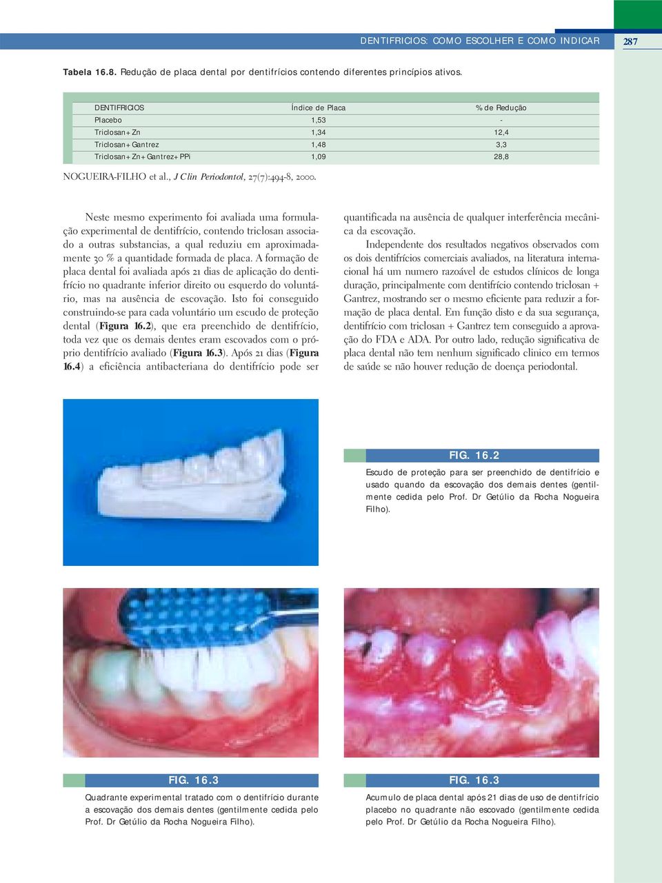 , J Clin Periodontol, 27(7):494-8, 2000.