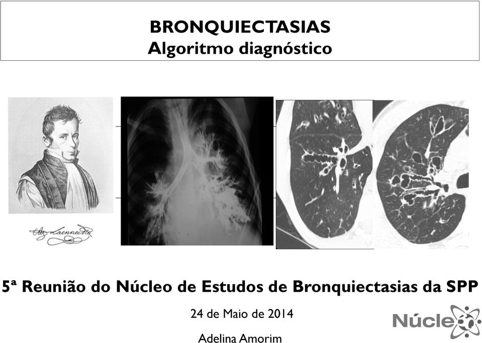 de Estudos de Bronquiectasias da