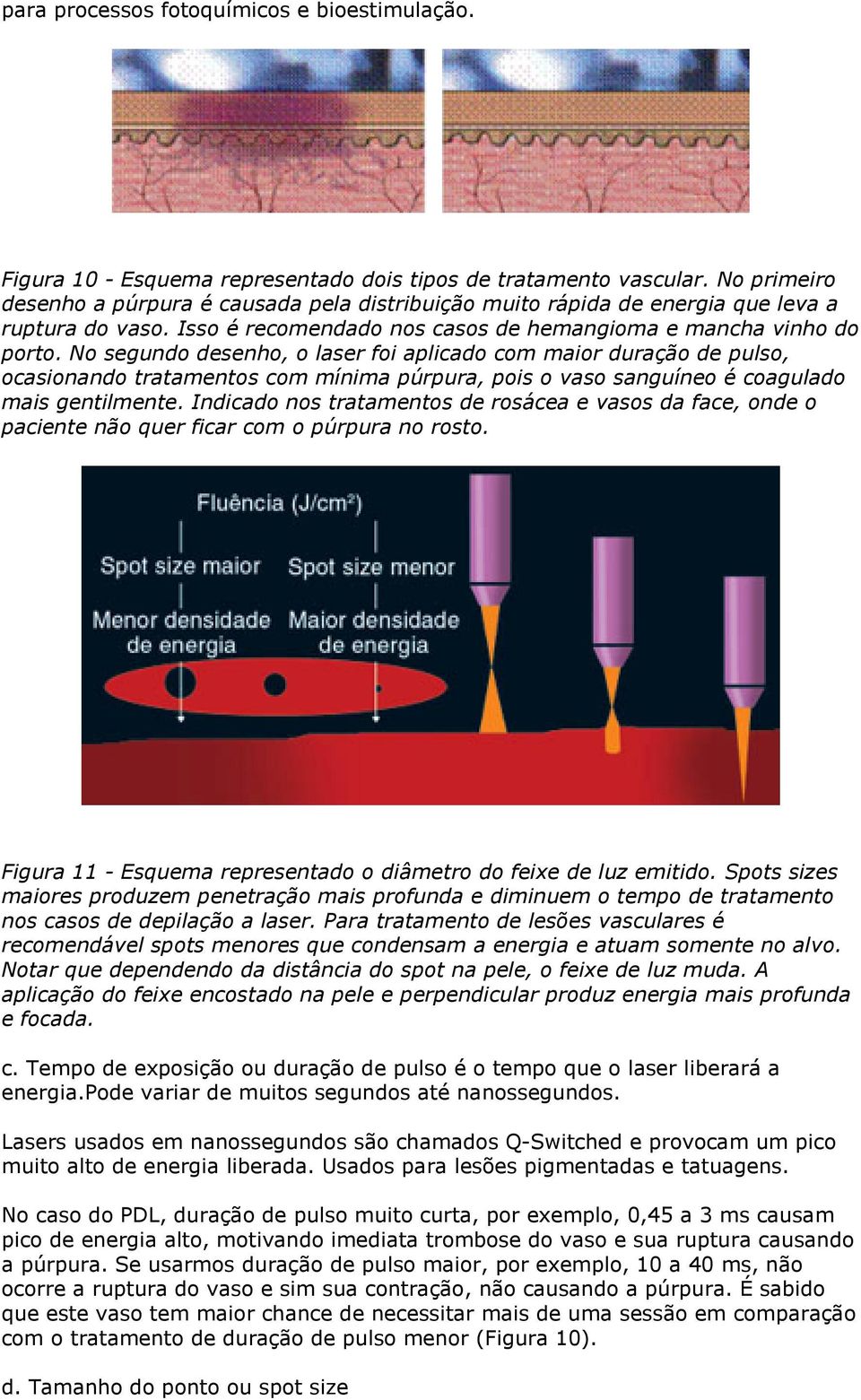 No segundo desenho, o laser foi aplicado com maior duração de pulso, ocasionando tratamentos com mínima púrpura, pois o vaso sanguíneo é coagulado mais gentilmente.