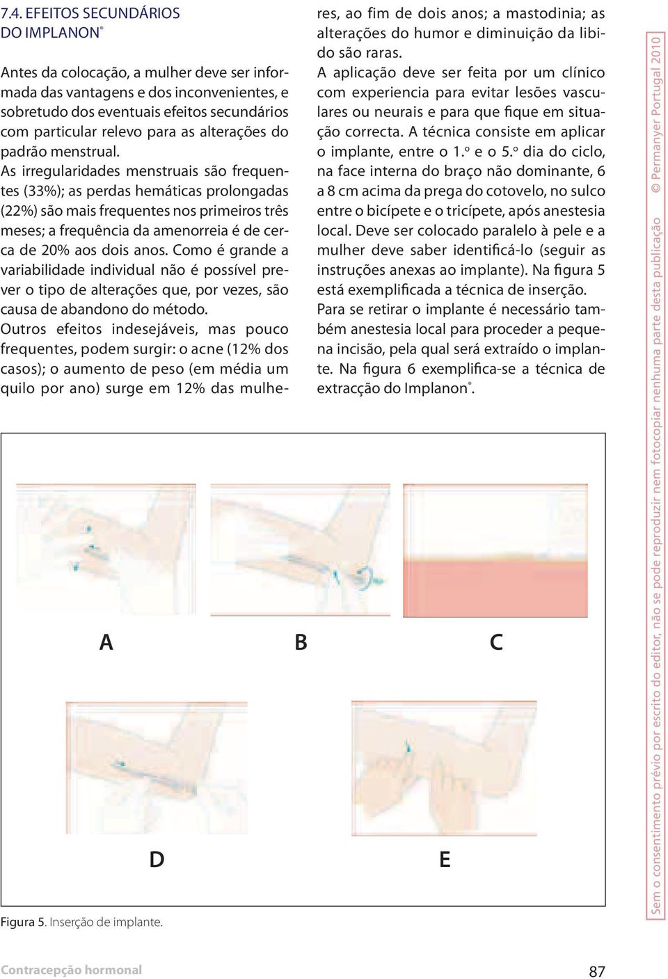 As irregularidades menstruais são frequentes (33%); as perdas hemáticas prolongadas (22%) são mais frequentes nos primeiros três meses; a frequência da amenorreia é de cerca de 20% aos dois anos.