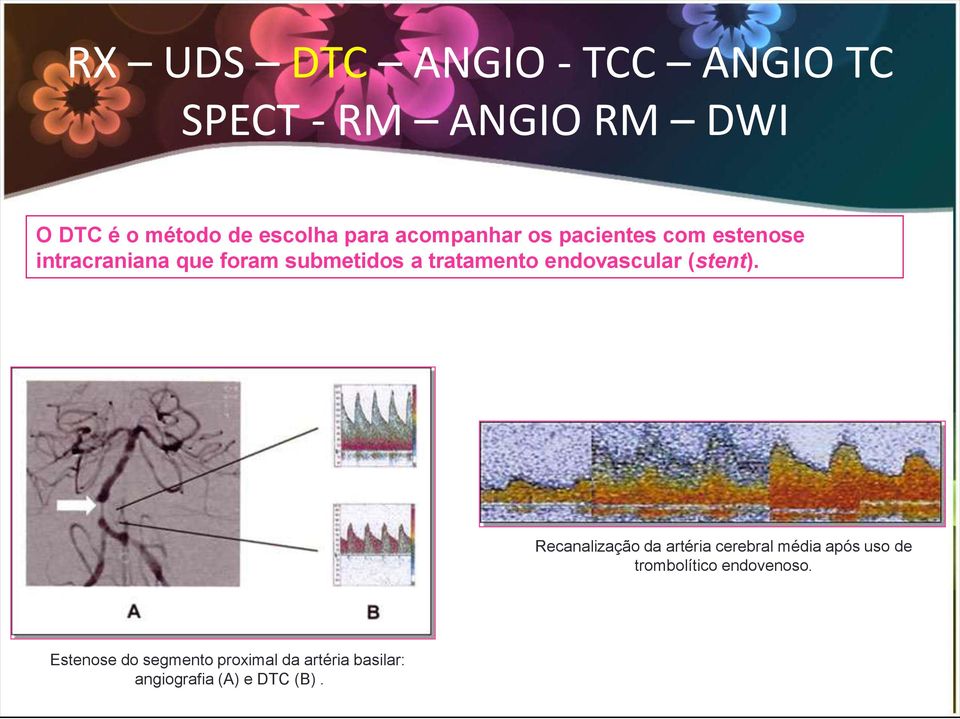 endovascular (stent).