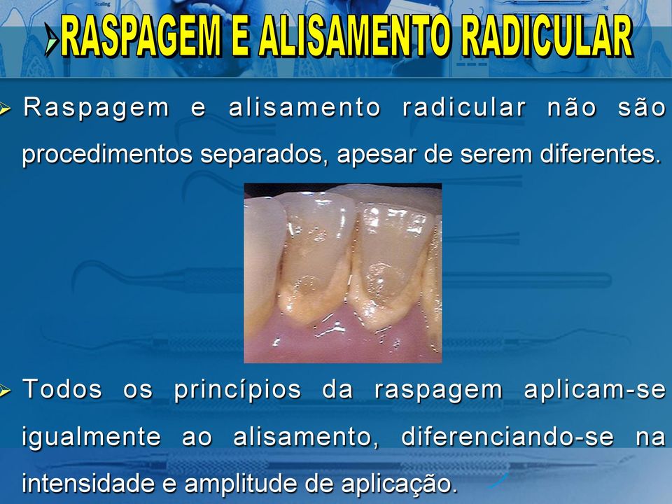 Todos os princípios da raspagem aplicam-se igualmente