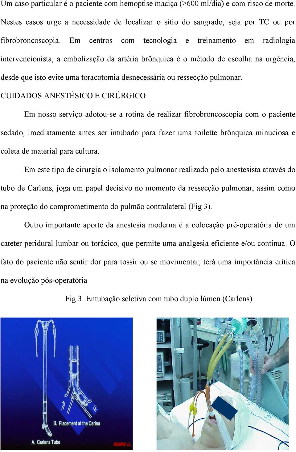 ressecção pulmonar.