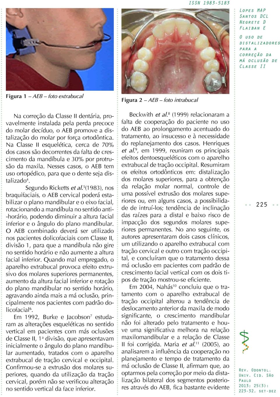 Nesses casos, o AEB tem uso ortopédico, para que o dente seja distalizado 4. Segundo Ricketts et al.