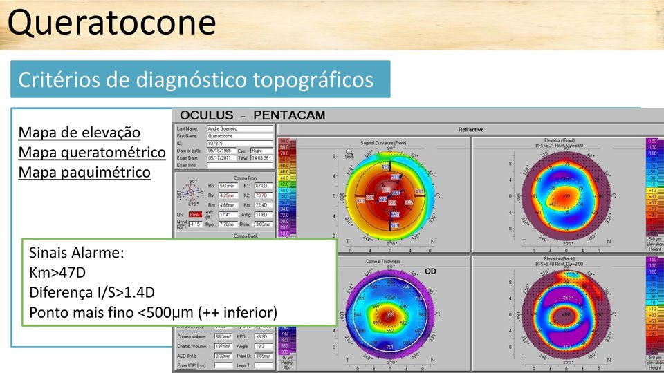 queratométrico Mapa paquimétrico Sinais