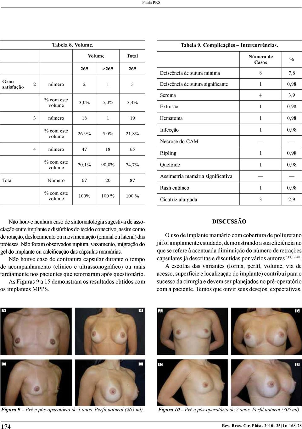 este volume 70,1% 90,0% 74,7% Total Número 67 20 87 % com este volume 100% 100 % 100 % Infecção 1 0,98 Necrose do CAM Ripling 1 0,98 Quelóide 1 0,98 Assimetria mamária significativa Rash cutâneo 1