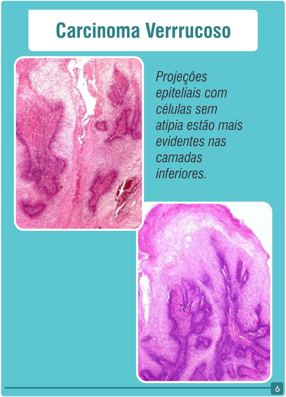 células sem atipia estão