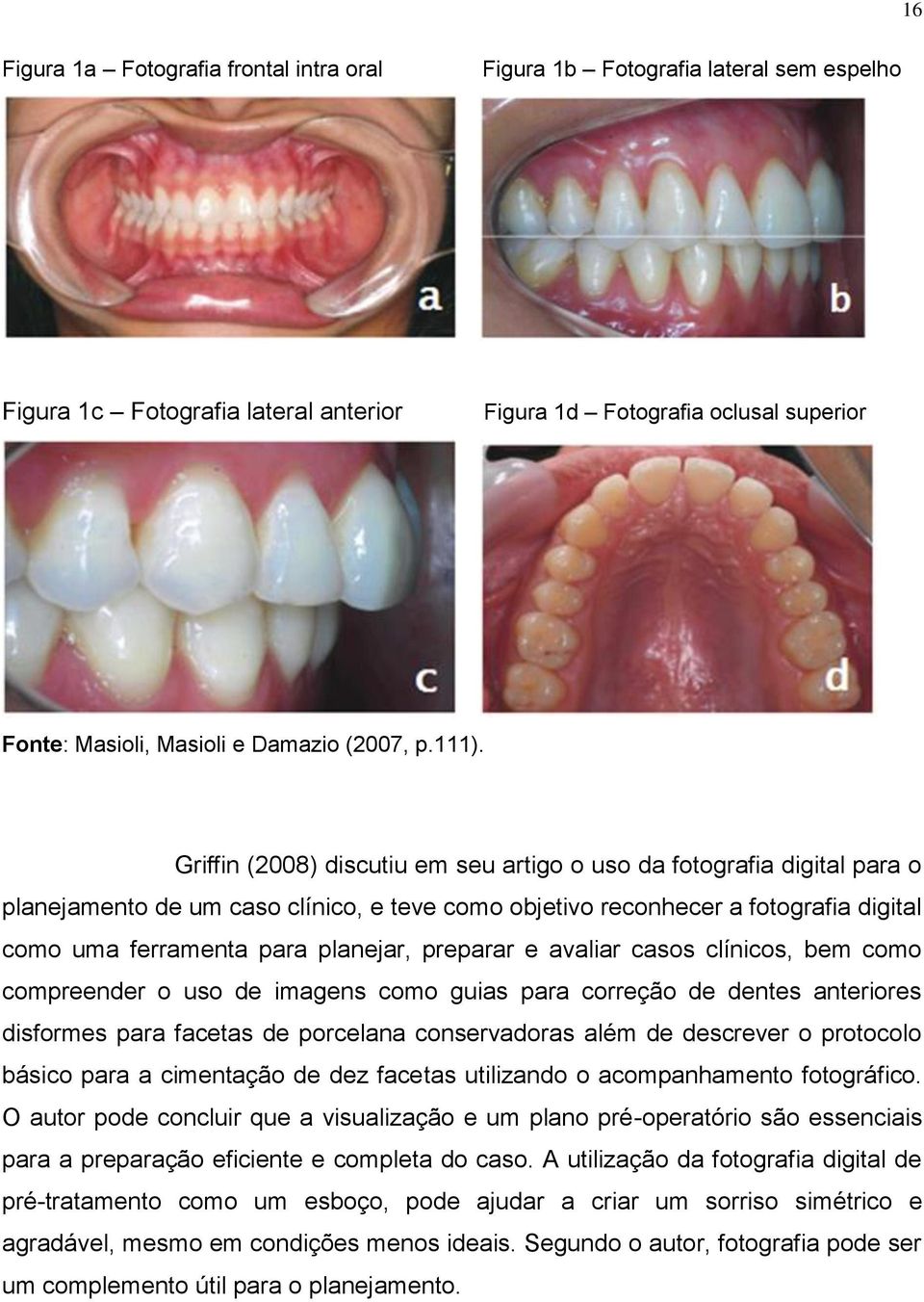 Griffin (2008) discutiu em seu artigo o uso da fotografia digital para o planejamento de um caso clínico, e teve como objetivo reconhecer a fotografia digital como uma ferramenta para planejar,