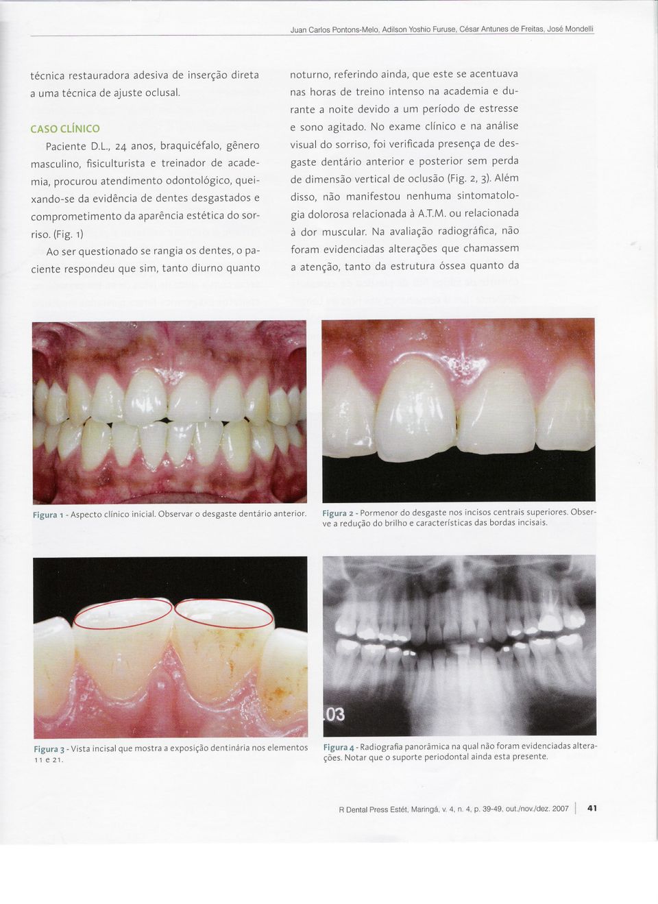 estética do sorriso. (Fig.