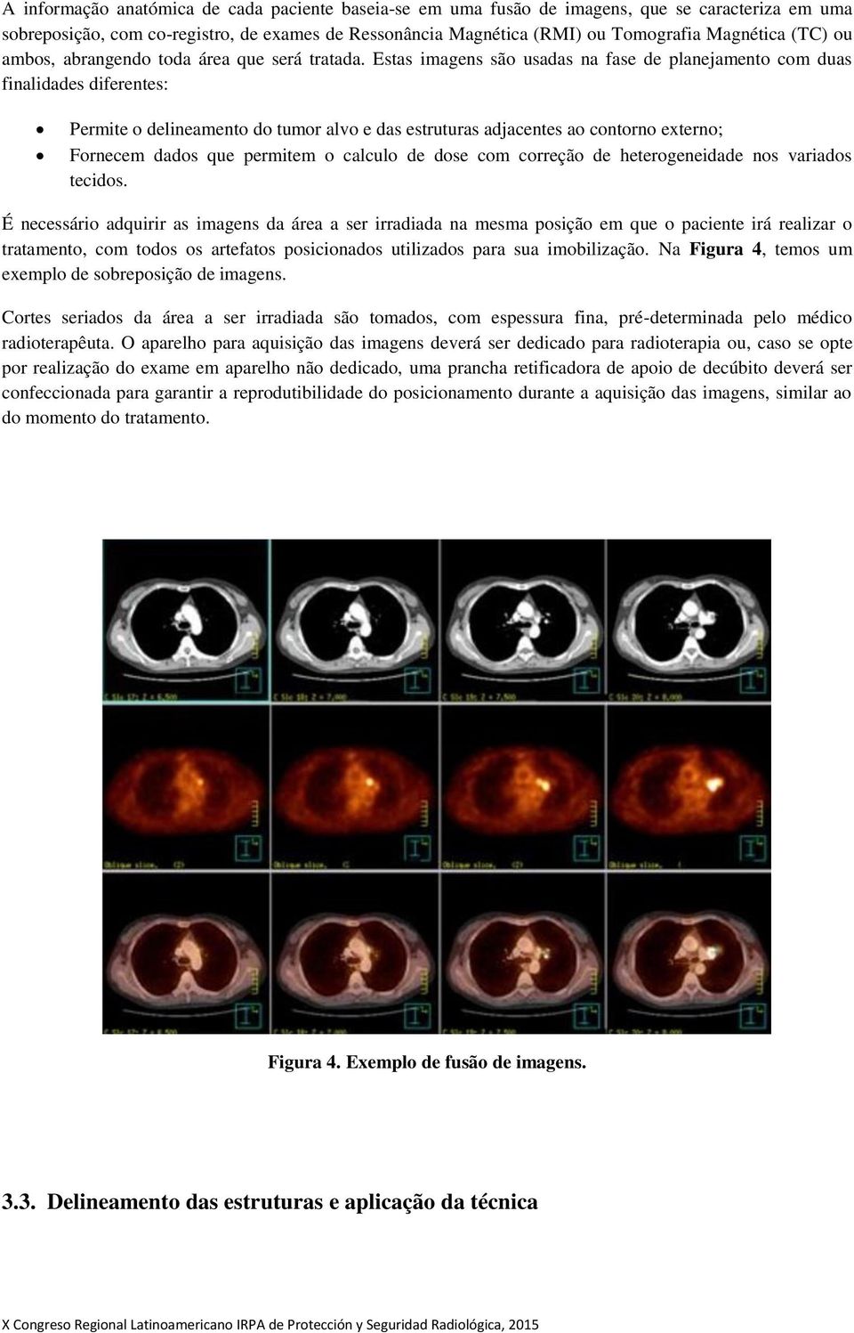 Estas imagens são usadas na fase de planejamento com duas finalidades diferentes: Permite o delineamento do tumor alvo e das estruturas adjacentes ao contorno externo; Fornecem dados que permitem o