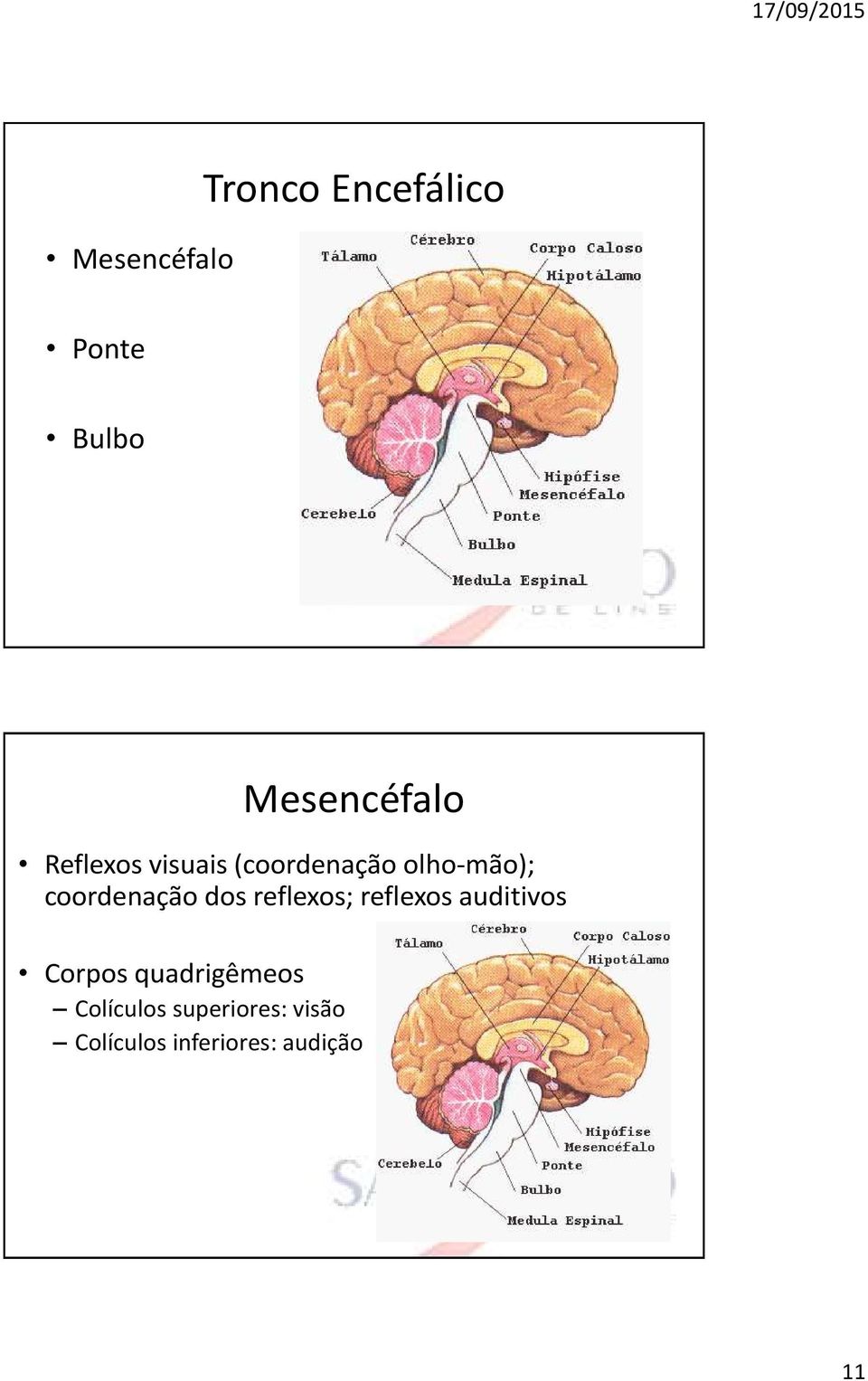 dos reflexos; reflexos auditivos Corpos quadrigêmeos