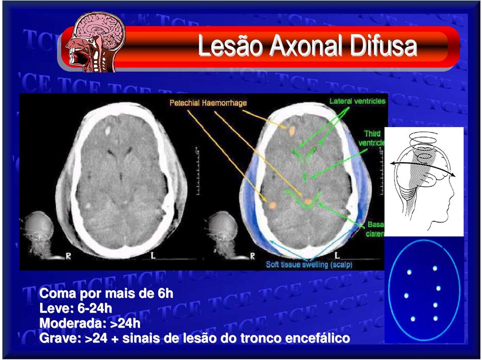 Moderada: >24h Grave: >24 +