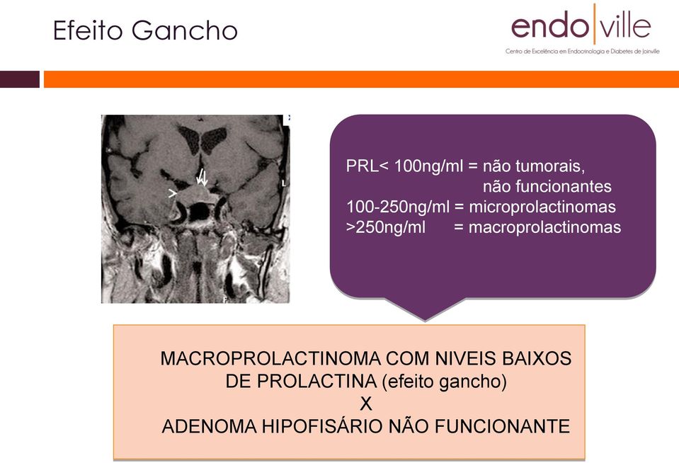 = macroprolactinomas MACROPROLACTINOMA COM NIVEIS BAIXOS