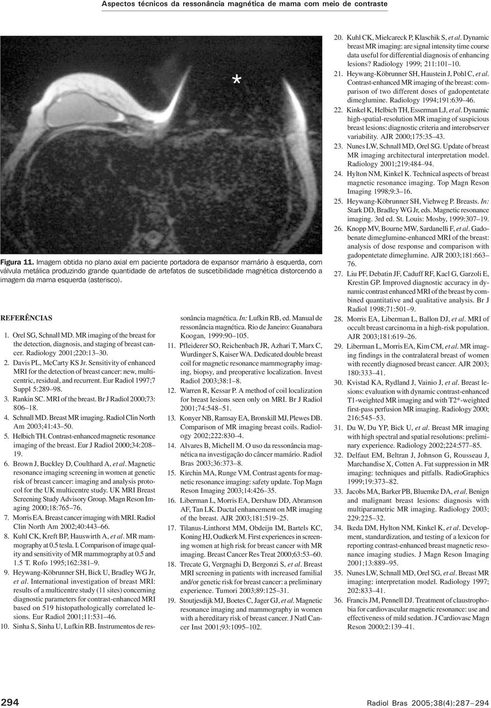 mama esquerda (asterisco). REFERÊNCIS 1. Orel SG, Schnall MD. MR imaging of the breast for the detection, diagnosis, and staging of breast cancer. Radiology 2001;220:13 30. 2. Davis PL, McCarty KS Jr.