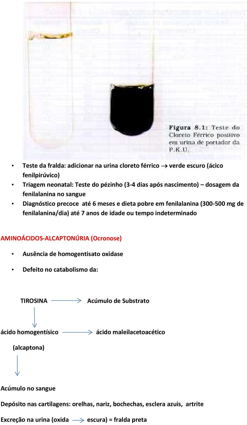 AMINOÁCIDOS-ALCAPTONÚRIA (Ocronose) Ausência de homogentisato oxidase Defeito no catabolismo da: TIROSINA Acúmulo de Substrato ácido homogentísico ácido