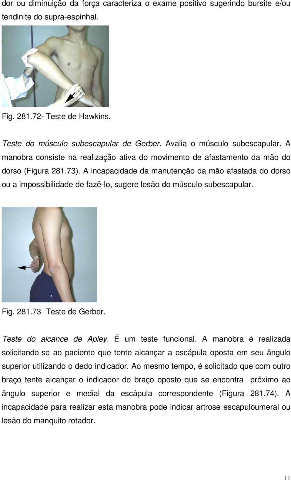 A incapacidade da manutenção da mão afastada do dorso ou a impossibilidade de fazê-lo, sugere lesão do músculo subescapular. Fig. 281.73- Teste de Gerber. Teste do alcance de Apley.