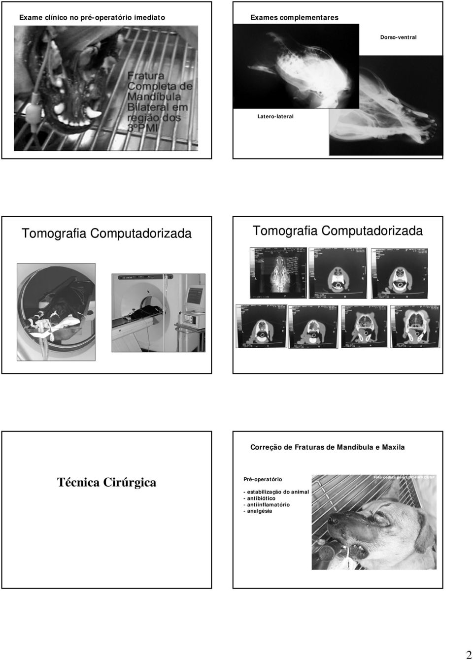 Computadorizada Correção de Fraturas de Mandíbula e Maxila Técnica