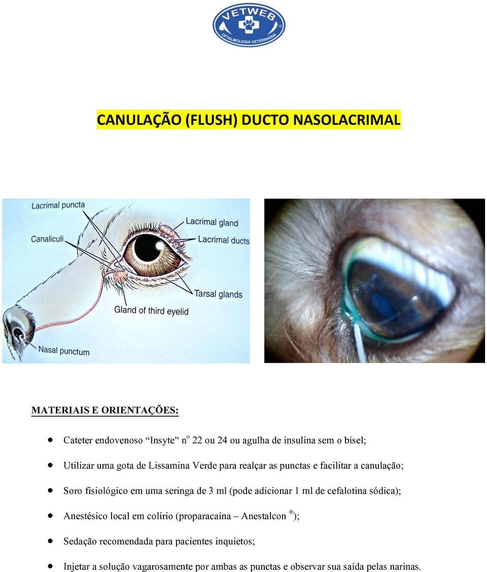 de 3 ml (pode adicionar 1 ml de cefalotina sódica); Anestésico local em colírio (proparacaína Anestalcon ); Sedação