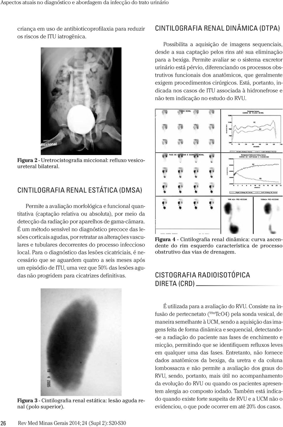 Permite avaliar se o sistema excretor urinário está pérvio, diferenciando os processos obstrutivos funcionais dos anatômicos, que geralmente exigem procedimentos cirúrgicos.