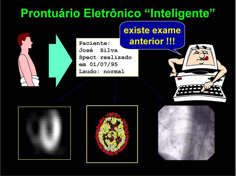 Silva Spect realizado em