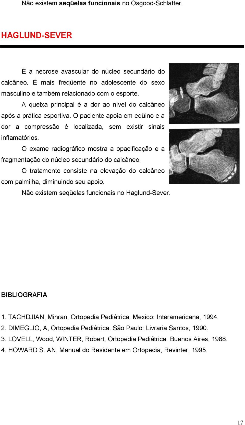 O paciente apoia em eqüino e a dor a compressão é localizada, sem existir sinais inflamatórios. O exame radiográfico mostra a opacificação e a fragmentação do núcleo secundário do calcâneo.