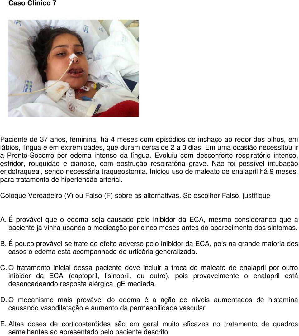 Não foi possível intubação endotraqueal, sendo necessária traqueostomia. Iniciou uso de maleato de enalapril há 9 meses, para tratamento de hipertensão arterial.