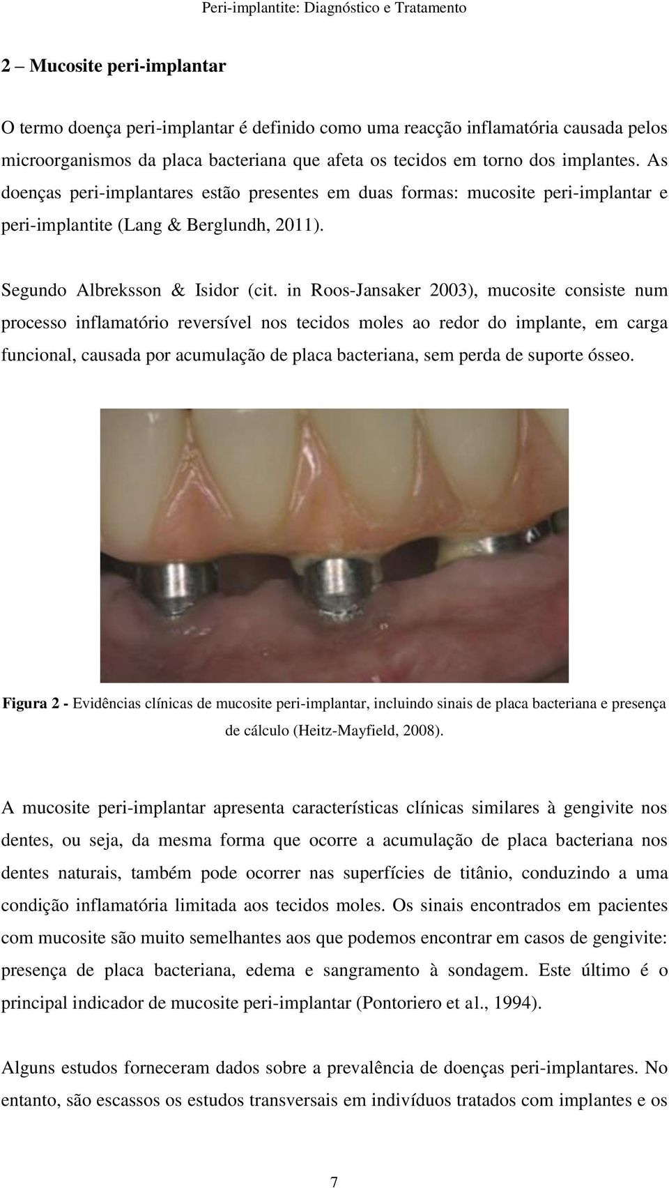 in Roos-Jansaker 2003), mucosite consiste num processo inflamatório reversível nos tecidos moles ao redor do implante, em carga funcional, causada por acumulação de placa bacteriana, sem perda de