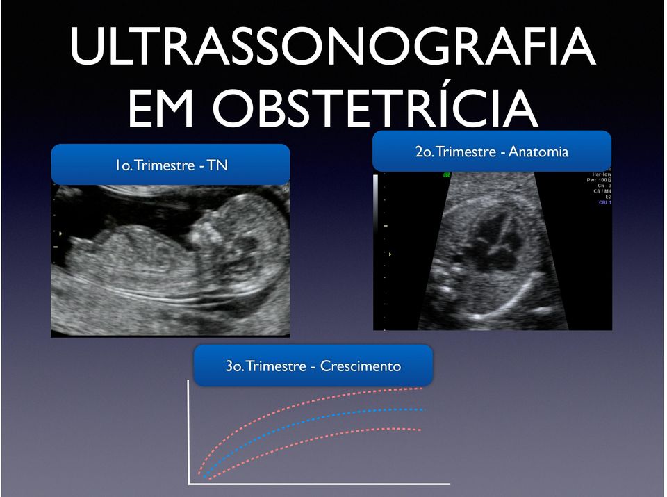 Trimestre - TN 2o.