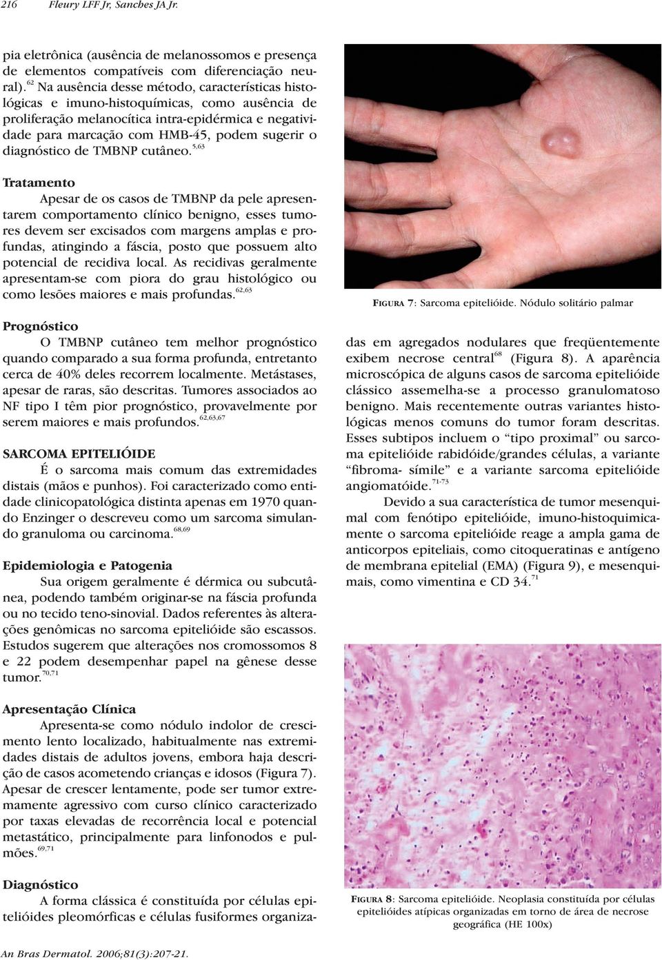 diagnóstico de TMBNP cutâneo.