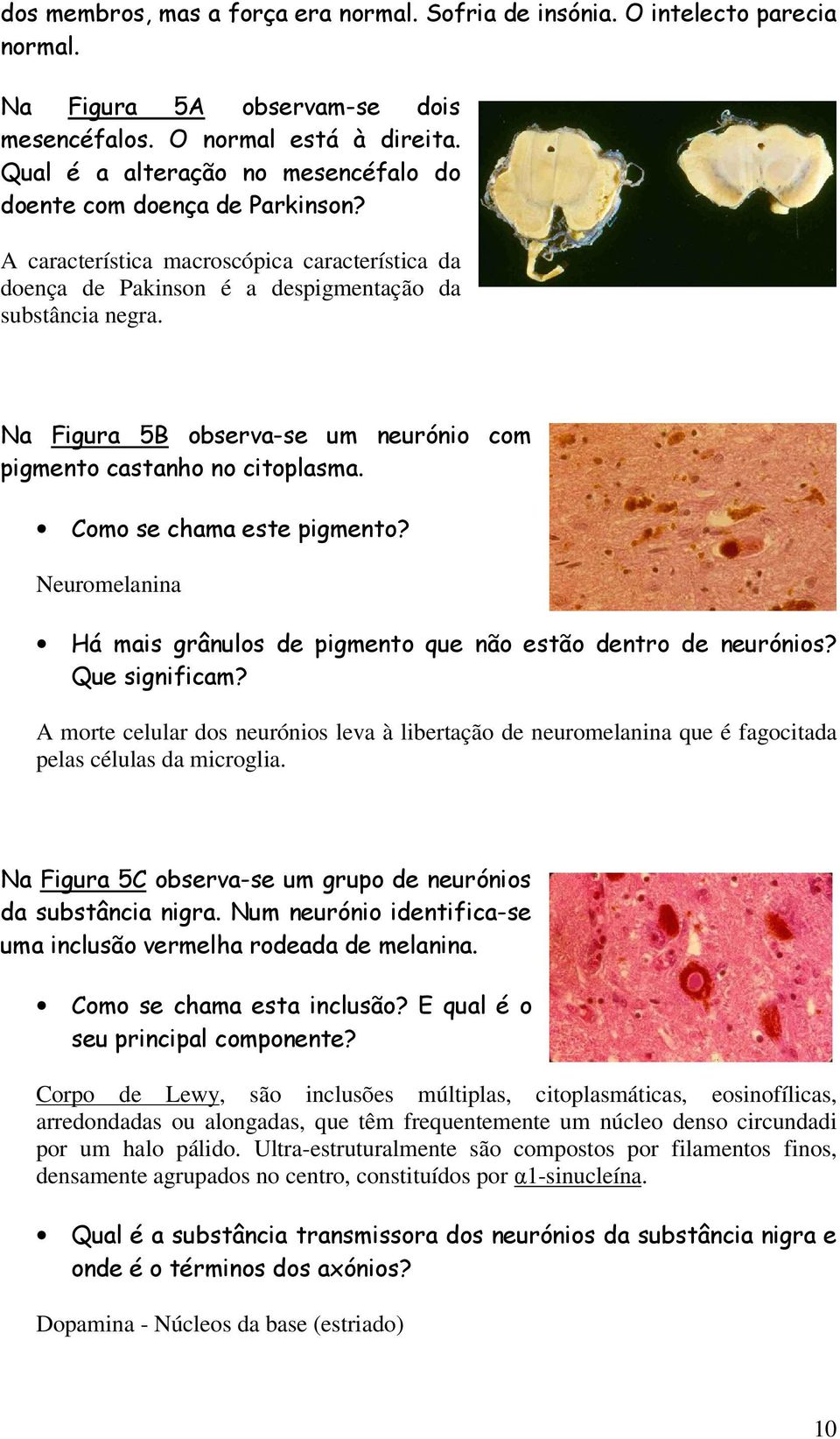 Na Figura 5B observa-se um neurónio com pigmento castanho no citoplasma. Como se chama este pigmento? Neuromelanina Há mais grânulos de pigmento que não estão dentro de neurónios? Que significam?