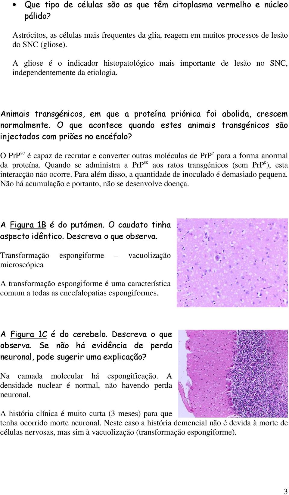 O que acontece quando estes animais transgénicos são injectados com priões no encéfalo? O PrP sc é capaz de recrutar e converter outras moléculas de PrP c para a forma anormal da proteína.