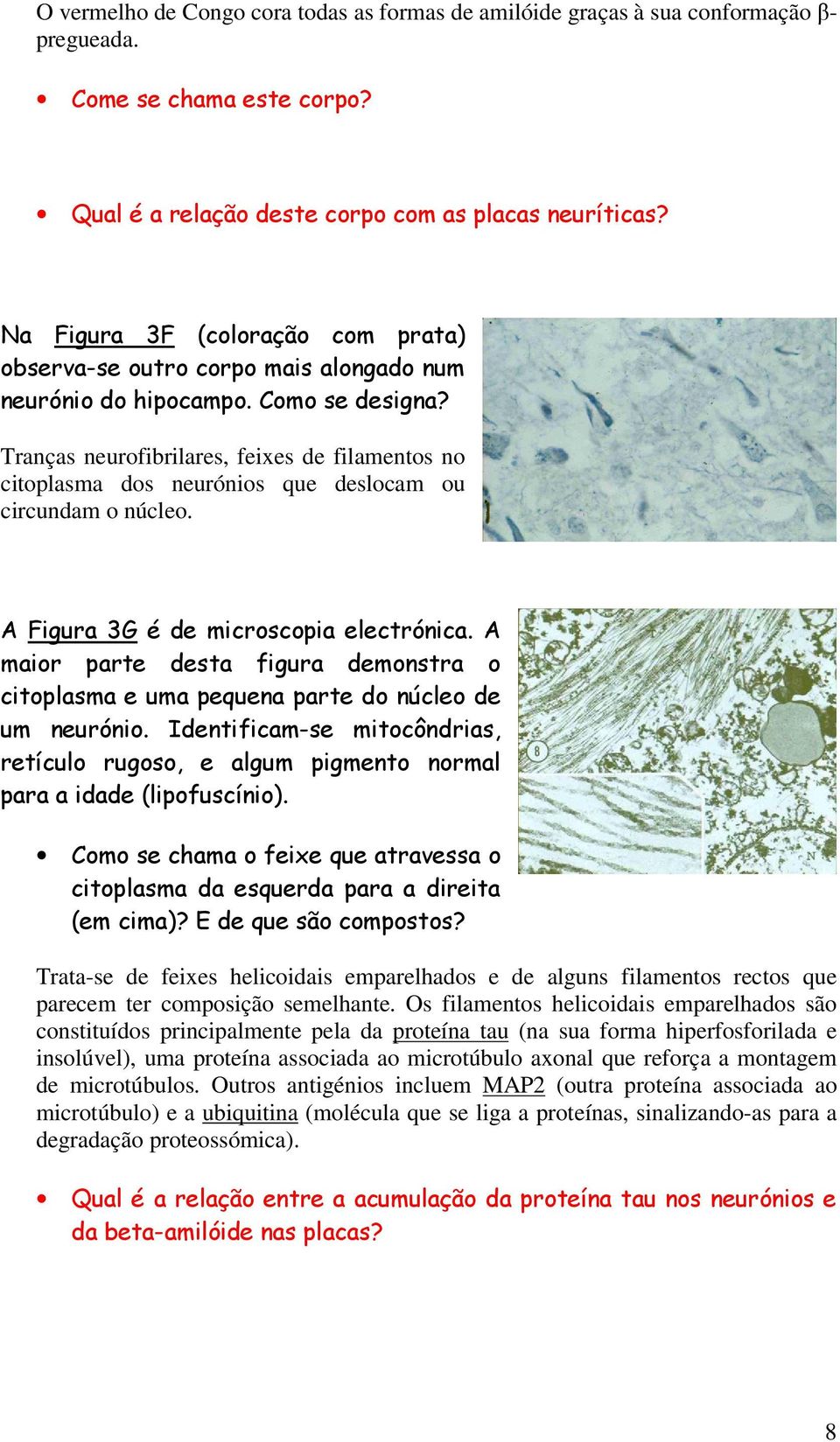 Tranças neurofibrilares, feixes de filamentos no citoplasma dos neurónios que deslocam ou circundam o núcleo. A Figura 3G é de microscopia electrónica.