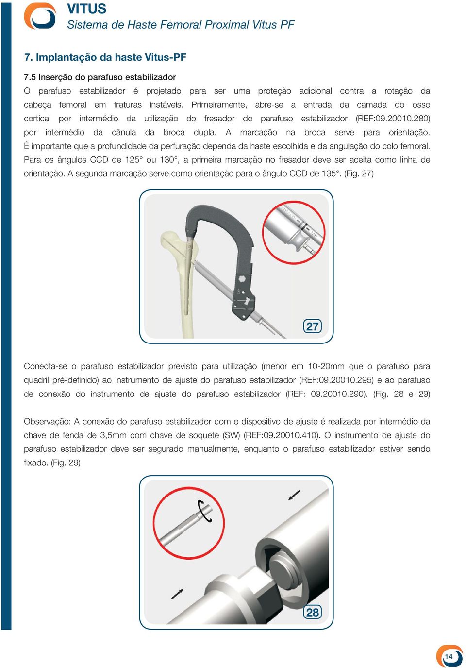 A marcação na broca serve para orientação. É importante que a profundidade da perfuração dependa da haste escolhida e da angulação do colo femoral.