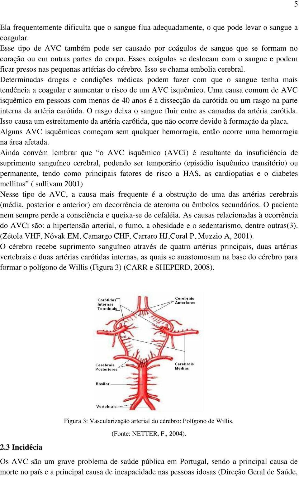 Esses coágulos se deslocam com o sangue e podem ficar presos nas pequenas artérias do cérebro. Isso se chama embolia cerebral.