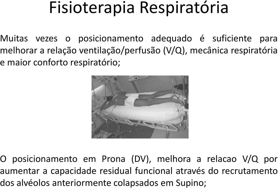 respiratório; O posicionamento em Prona (DV), melhora a relacao V/Q por aumentar a