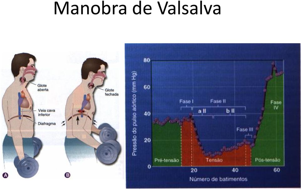 Valsalva