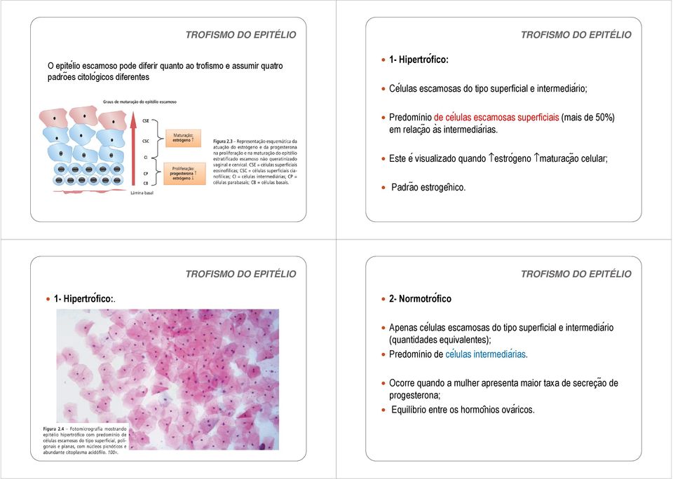 Este e visualizado quando estroǵeno maturac aõ celular; Padraõ estroge nico. 1- Hipertro fico:.