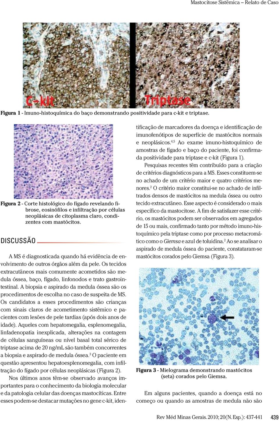 DISCUSSÃO A MS é diagnosticada quando há evidência de envolvimento de outros órgãos além da pele.