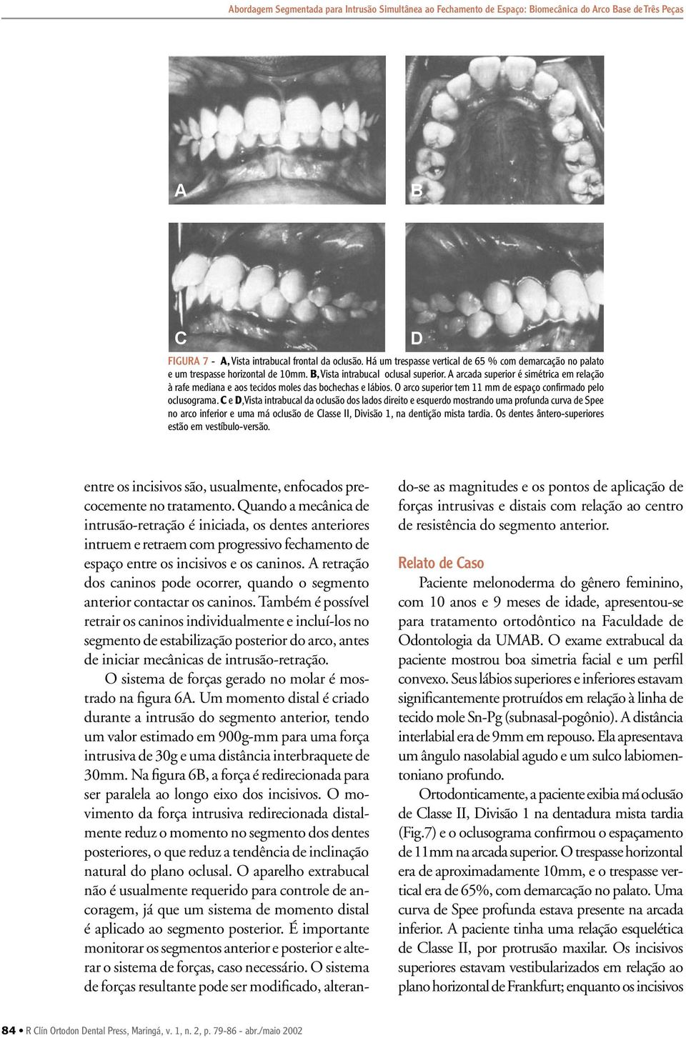 arcada superior é simétrica em relação à rafe mediana e aos tecidos moles das bochechas e lábios. O arco superior tem 11 mm de espaço confirmado pelo oclusograma.