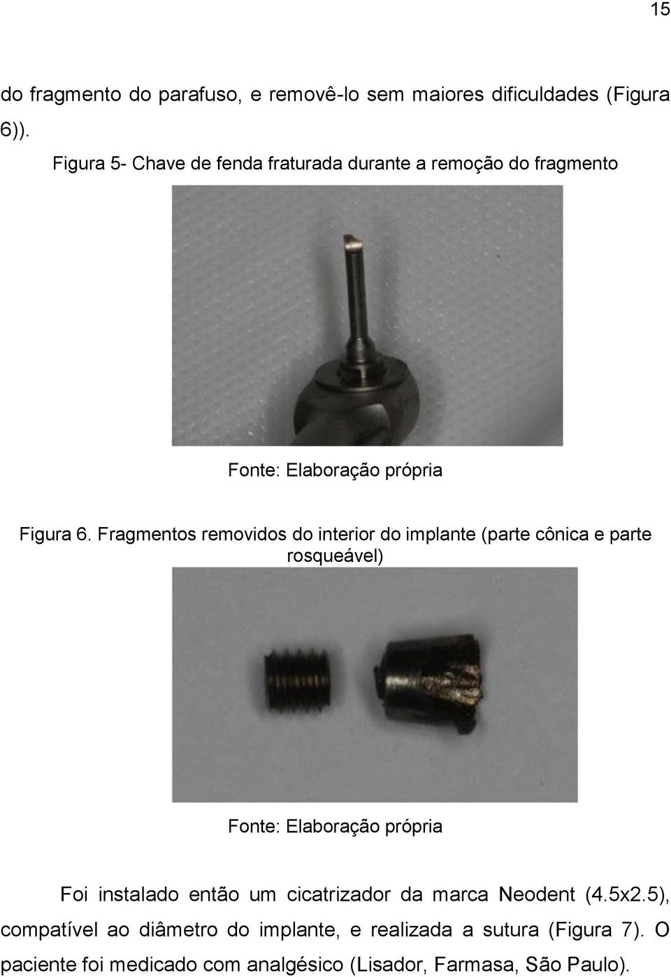 Fragmentos removidos do interior do implante (parte cônica e parte rosqueável) Fonte: Elaboração própria Foi instalado