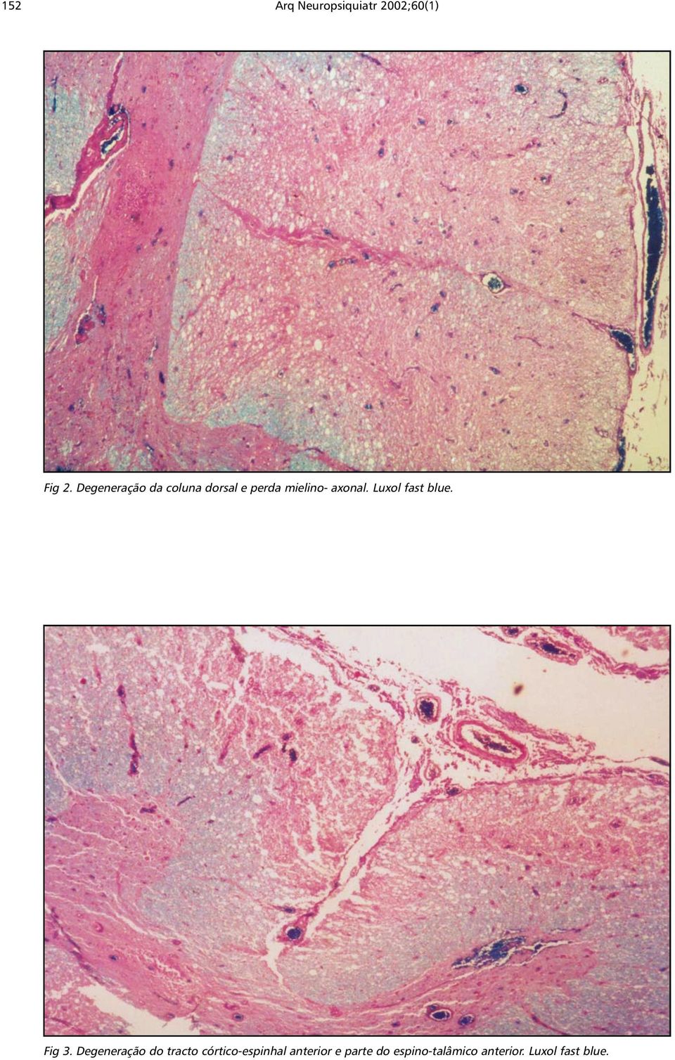 Luxol fast blue. Fig 3.