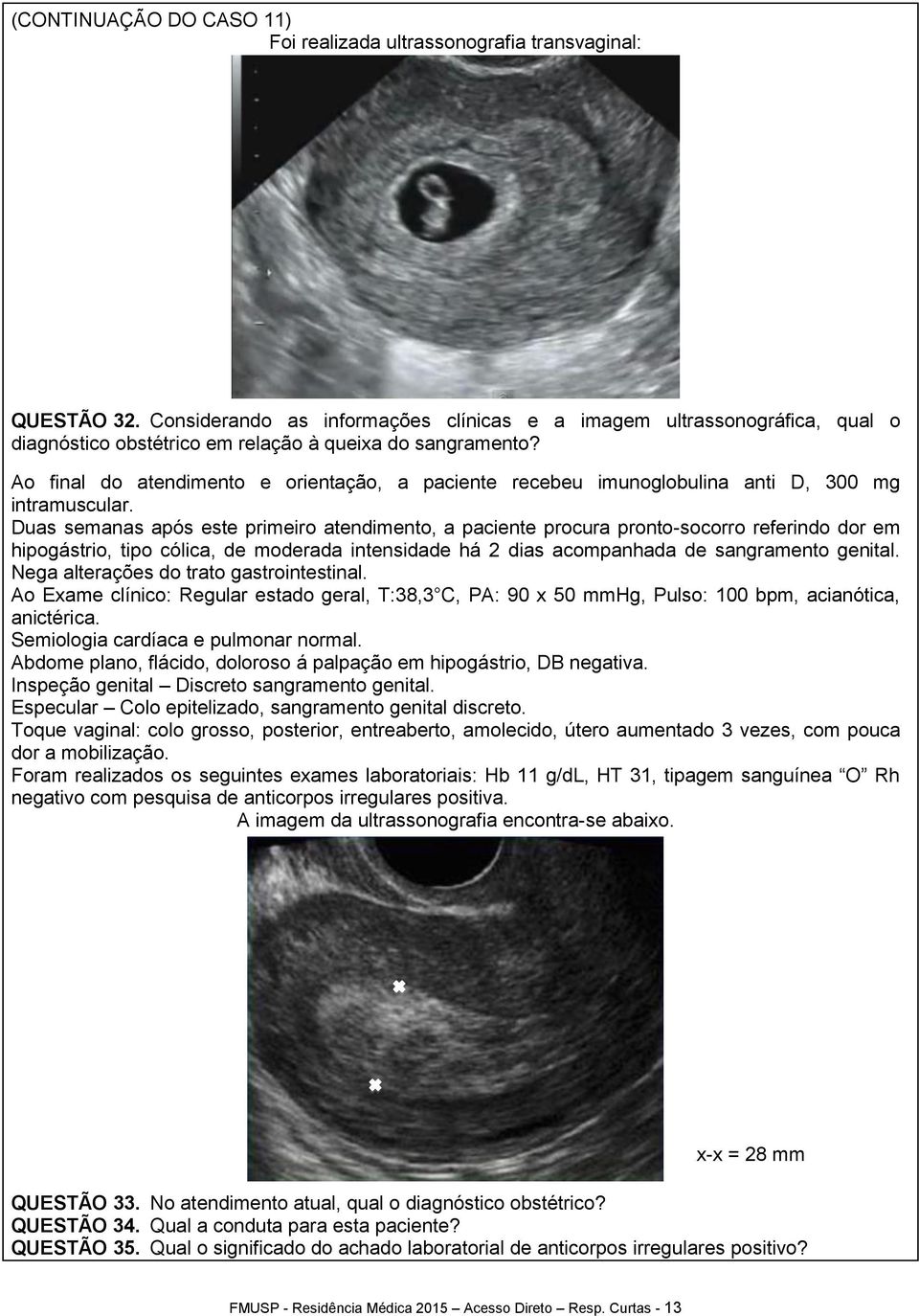 Ao final do atendimento e orientação, a paciente recebeu imunoglobulina anti D, 300 mg intramuscular.