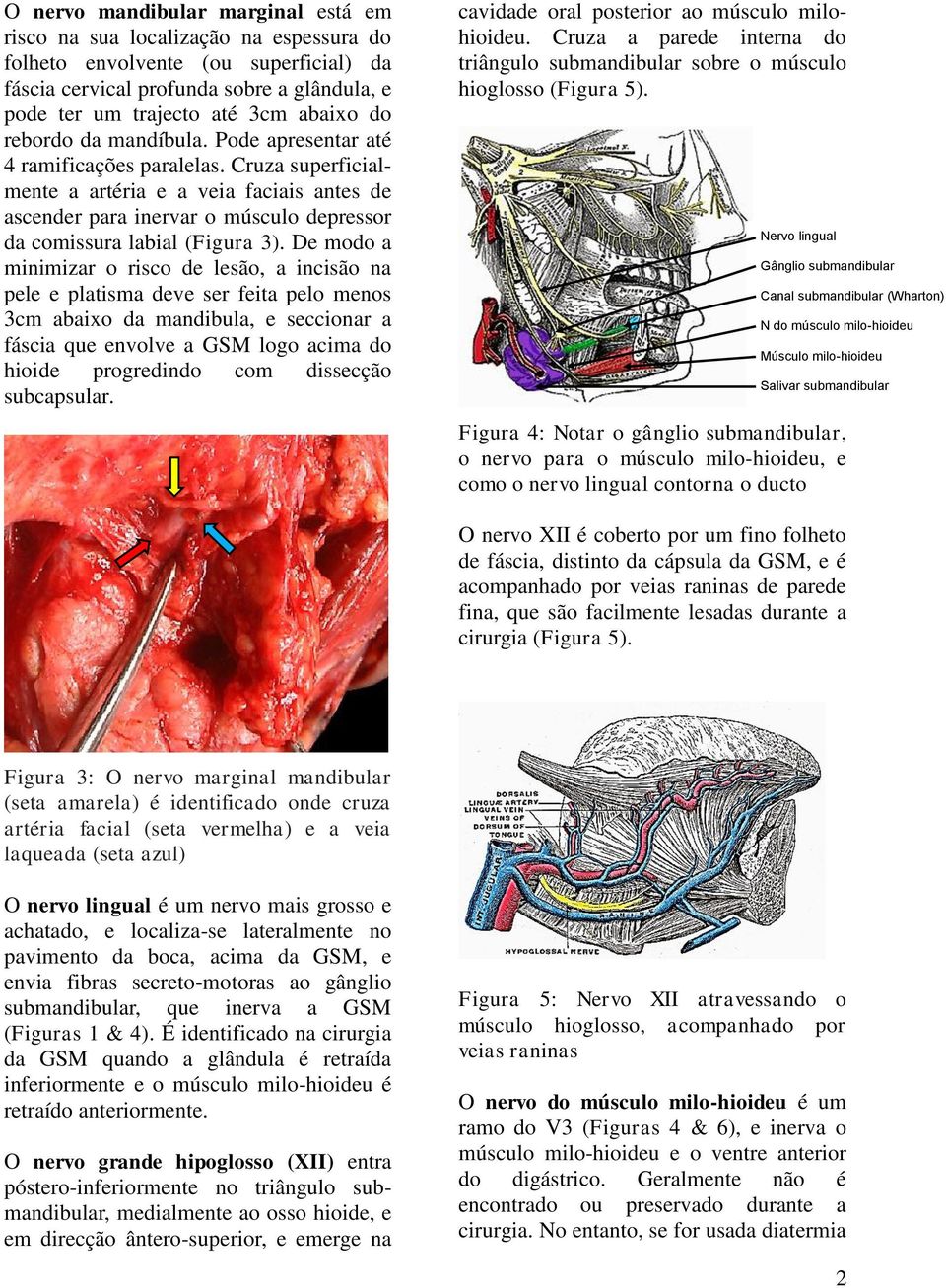 De modo a minimizar o risco de lesão, a incisão na pele e platisma deve ser feita pelo menos 3cm abaixo da mandibula, e seccionar a fáscia que envolve a GSM logo acima do hioide progredindo com