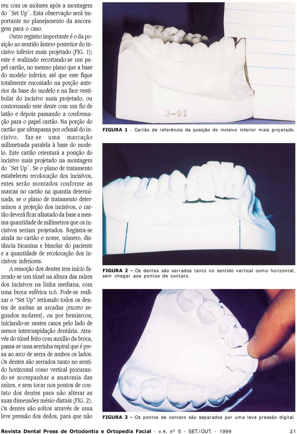 ); este é realizado recortandose um papel cartão, no mesmo plano que a base do modelo inferior, até que este fique totalmente encostado na porção anterior da base do modelo e na face vestibular do