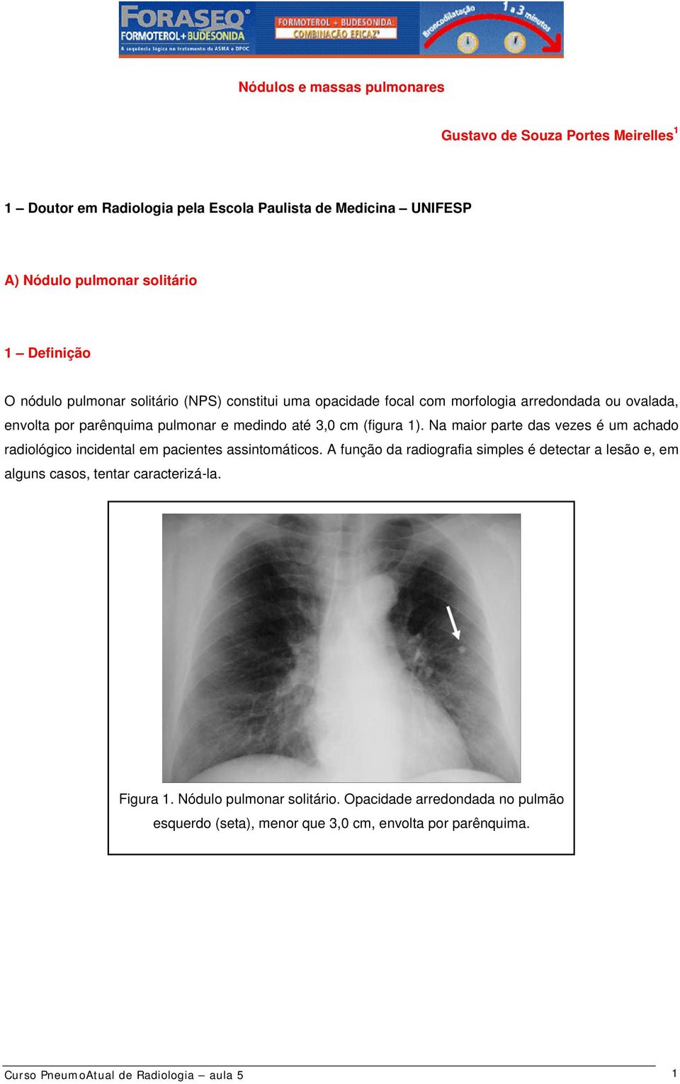 Na maior parte das vezes é um achado radiológico incidental em pacientes assintomáticos.