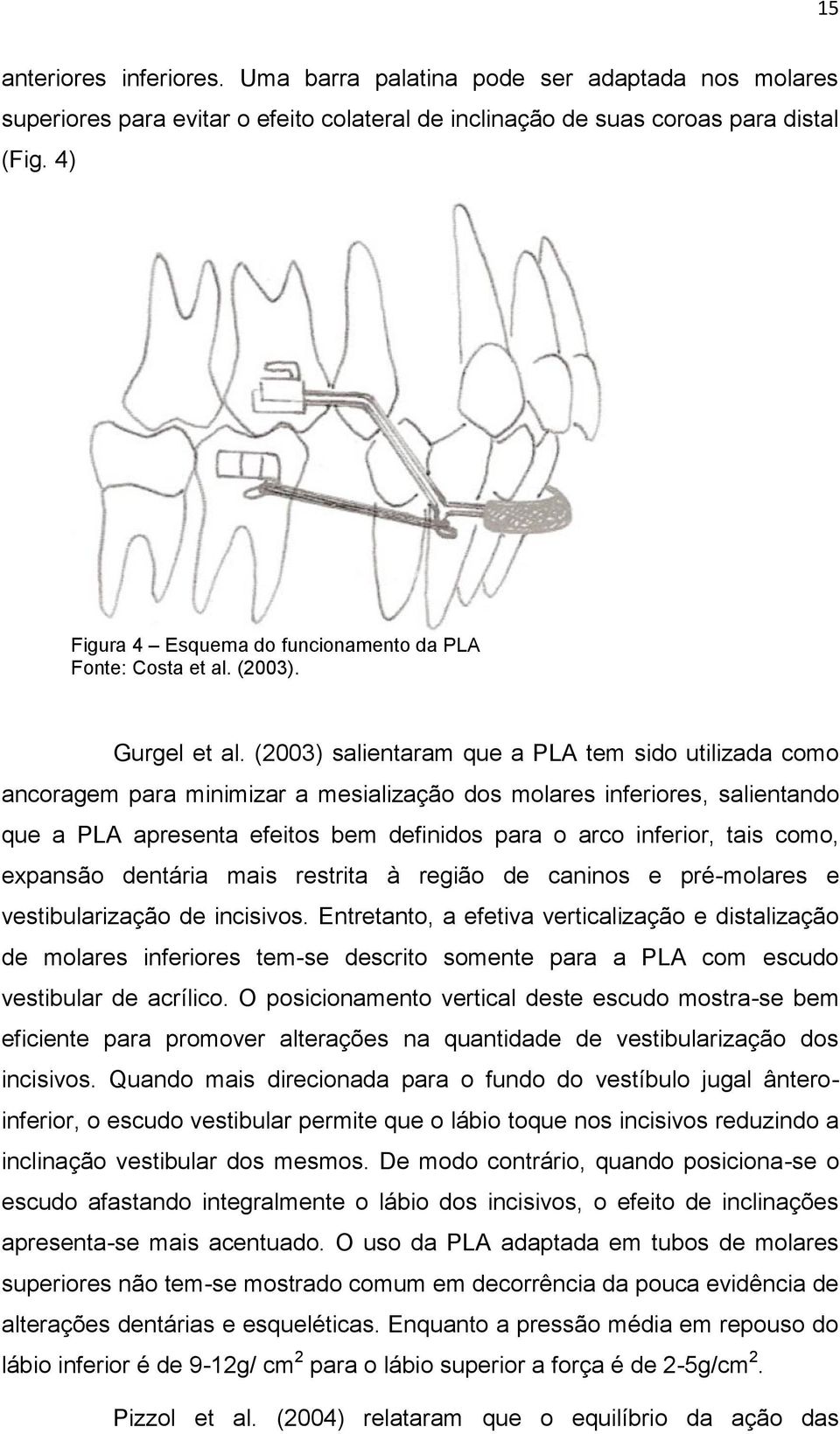 (2003) salientaram que a PLA tem sido utilizada como ancoragem para minimizar a mesialização dos molares inferiores, salientando que a PLA apresenta efeitos bem definidos para o arco inferior, tais